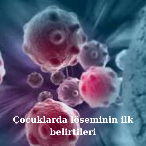 Çocuklarda löseminin ilk belirtileri