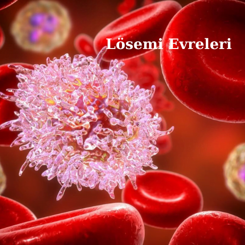 Lösemi evreleri