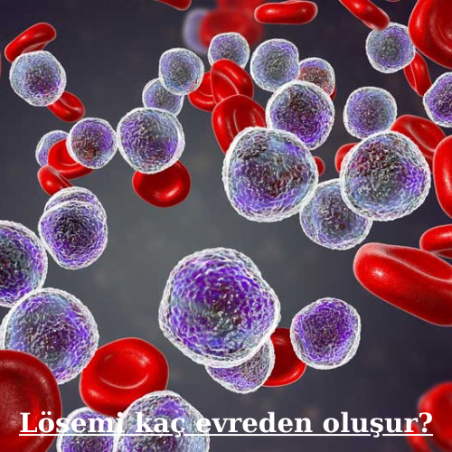 Lösemi kaç evreden oluşur?