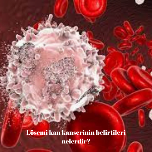 Lösemi kan kanserinin belirtileri nelerdir?